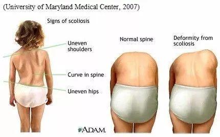 成人脊柱调理手法视频,专业指导,轻松掌握健康之道