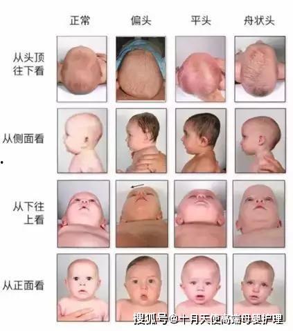 成人偏头可以矫正吗视频,揭秘矫正方法与效果